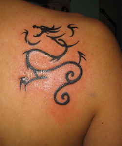 Laser Tatto Removal on Pinknews Co Uklaser Tattoo Removal Is An