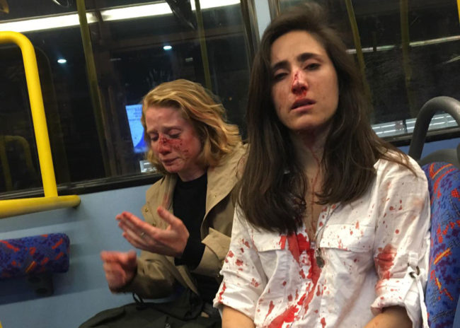 Two women on a bus covered in blood condemned Boris Johnson